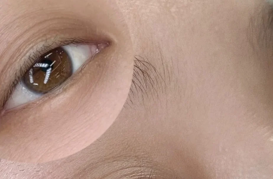 Eyeliner embroidery, open-eye view, SkinRev Lab Singapore