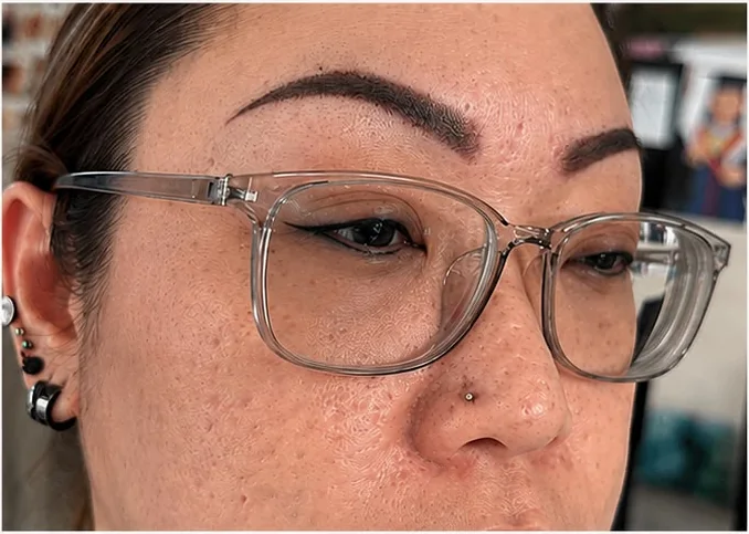 Eyebrow embroidery after, rebuilt brow shape, SkinRev Lab Singapore