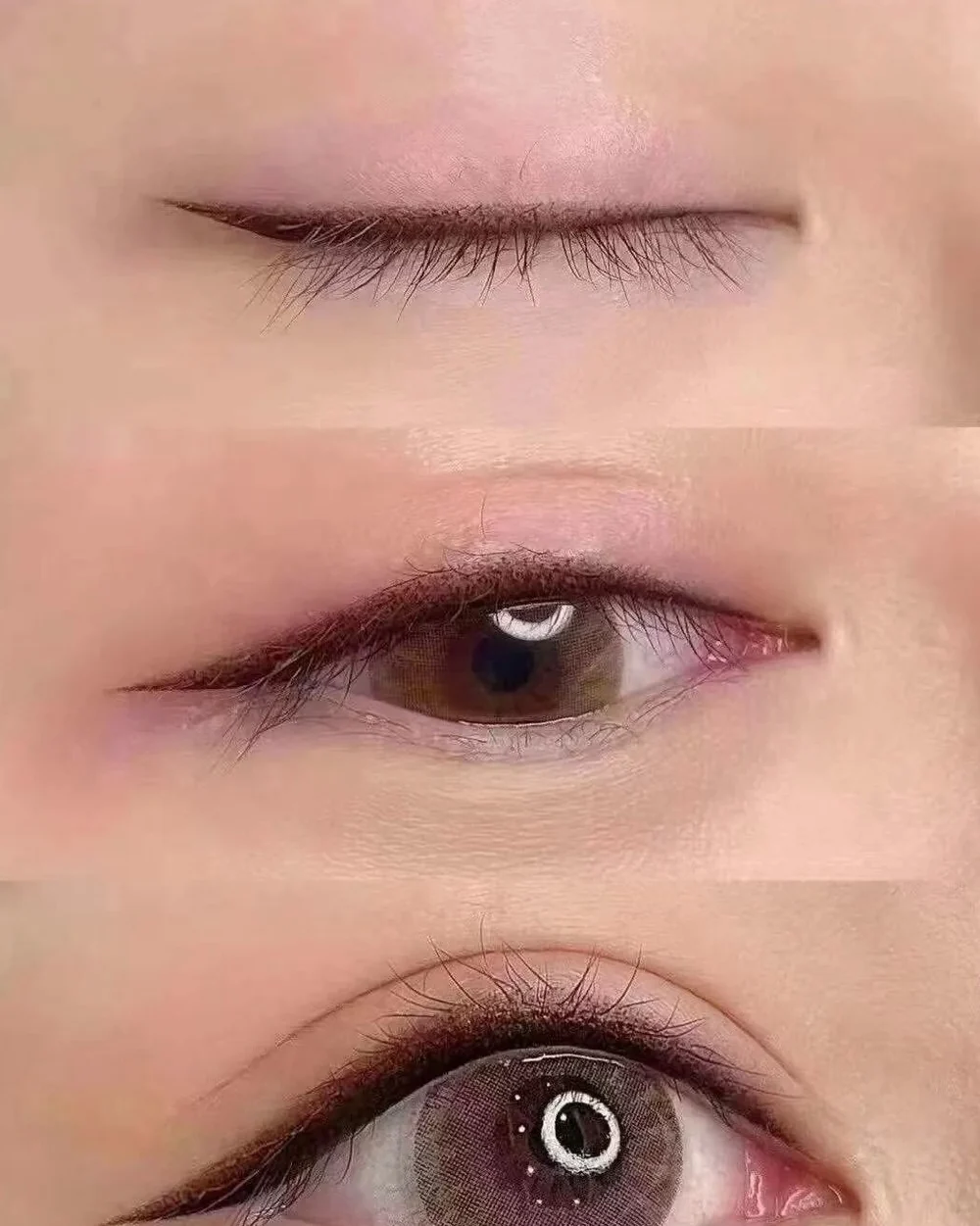 Eyeliner embroidery before and after, lash-line enhancement, SkinRev Lab Singapore