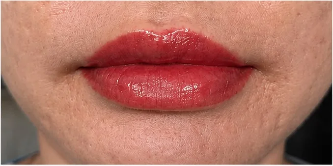 Lip blush after, even tone and defined border, SkinRev Lab Singapore