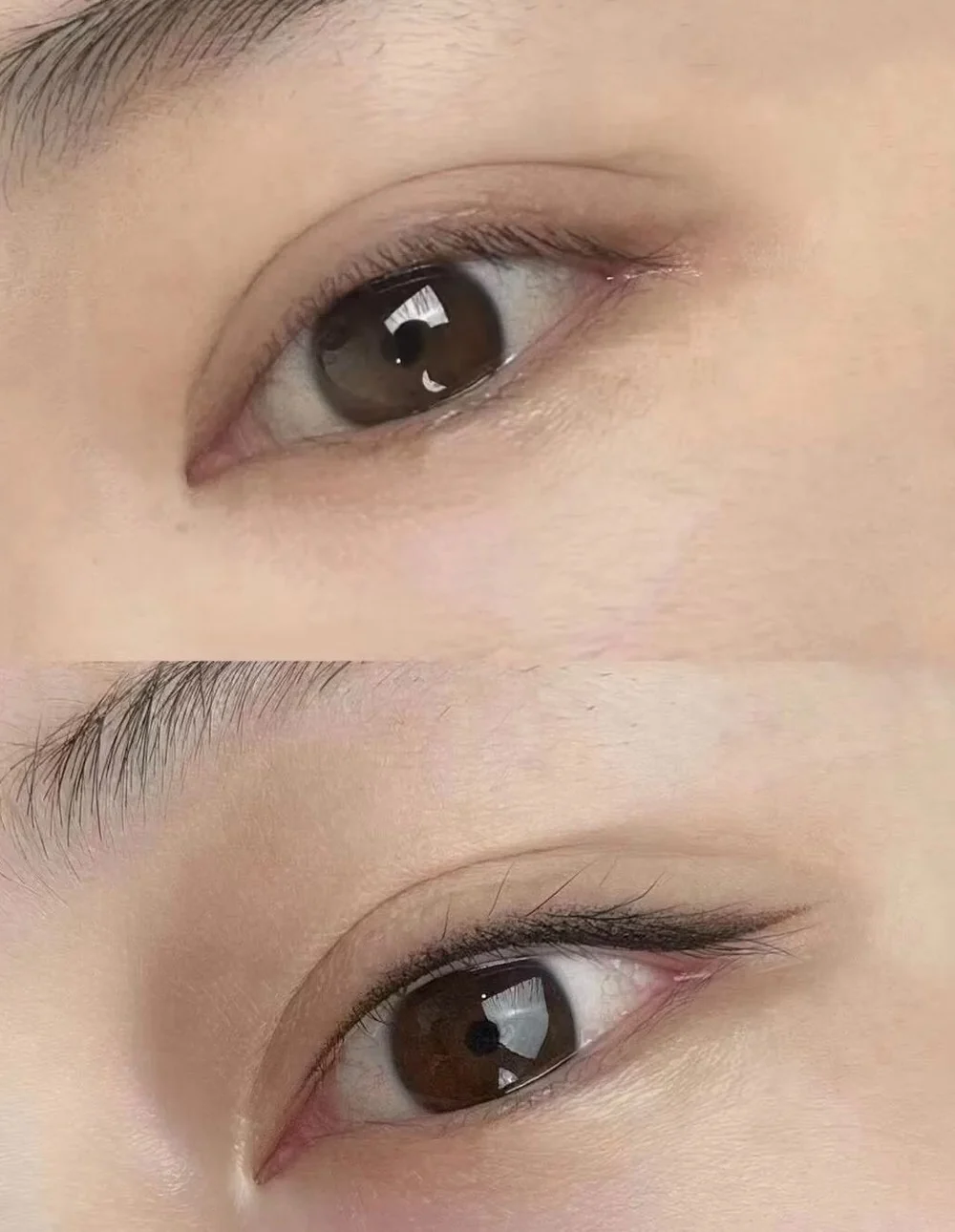 Eyeliner embroidery, lash-line definition, SkinRev Lab Singapore